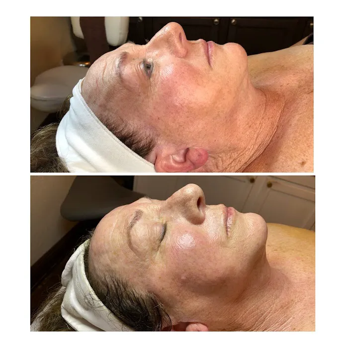 Bella TheSe Day Spa Picture 1