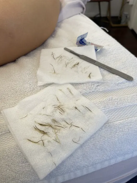 Balanced Skin and Acne Clinic Picture 2