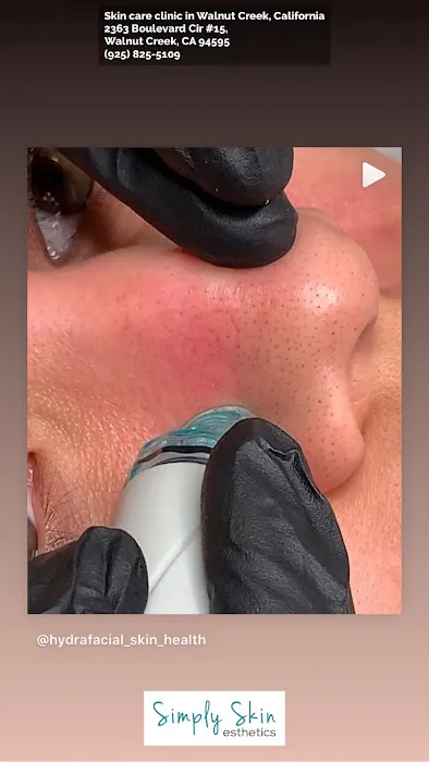 Simply Skin Esthetics Picture 6