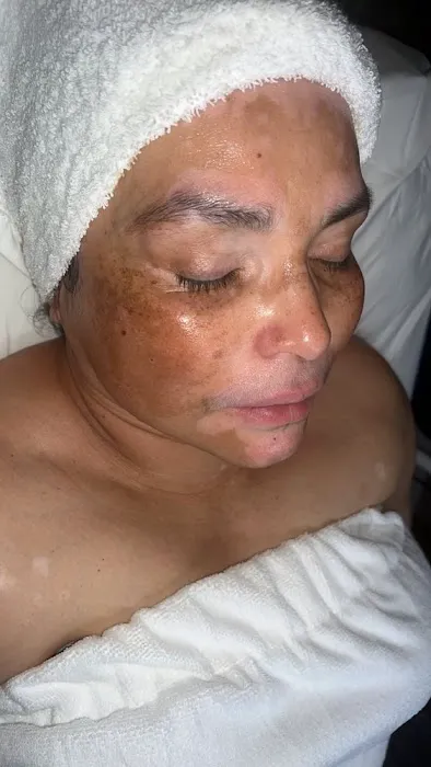 Sonder Skin Picture 2