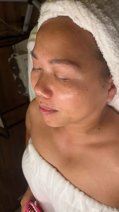 Sonder Skin Picture 3