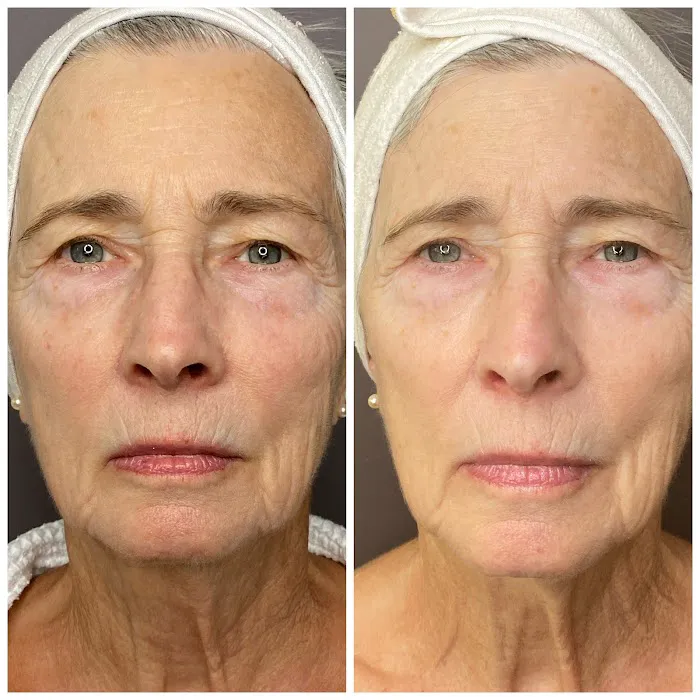 Body Celebration - Holistic Skincare & Wellness Picture 6