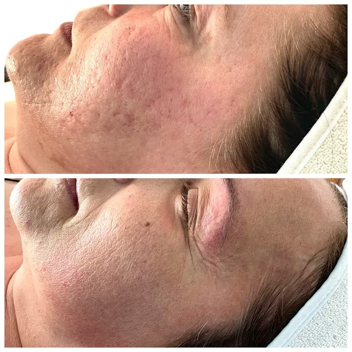 Body Celebration - Holistic Skincare & Wellness Picture 7