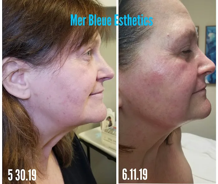 Mer Bleue Esthetics Picture 10