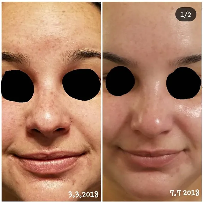 Mer Bleue Esthetics Picture 9