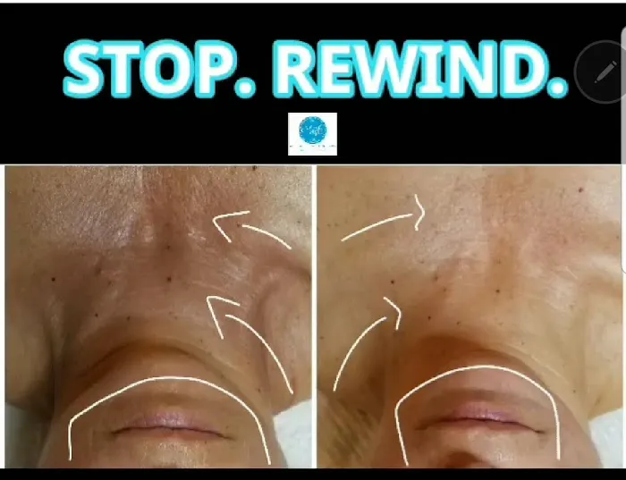 Mer Bleue Esthetics Picture 8