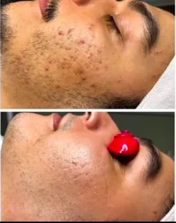 Acne Specialists of Walnut Creek Picture 9