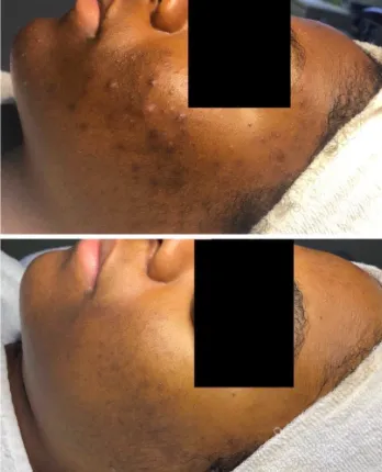 Acne Specialists of Walnut Creek Picture 10