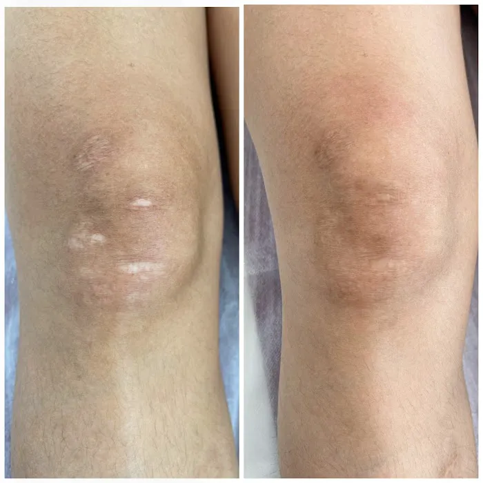 Invisible Ink Skin Solutions Picture 1