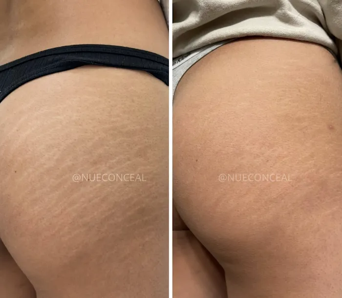 Invisible Ink Skin Solutions Picture 2