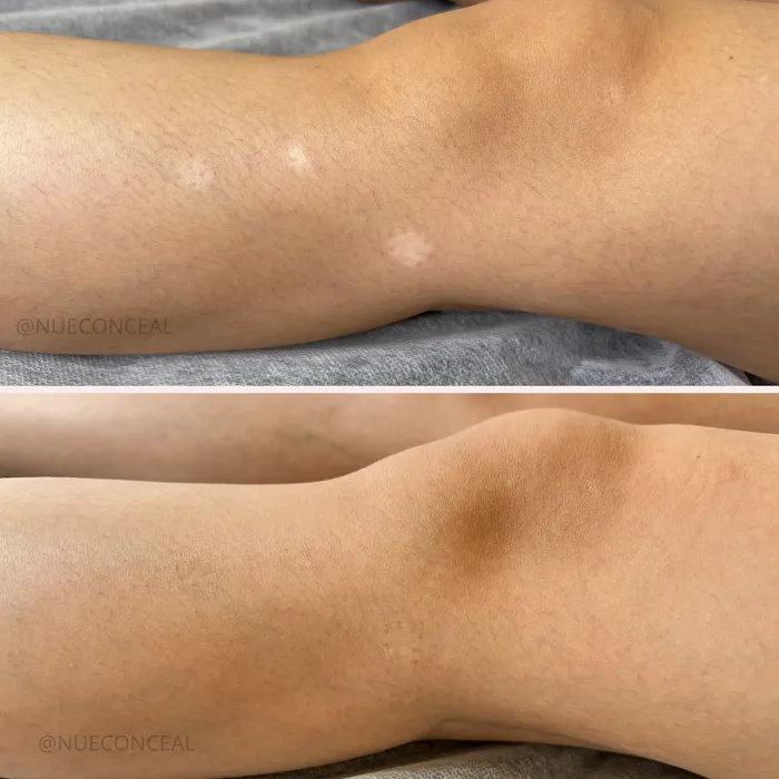 Invisible Ink Skin Solutions Picture 3