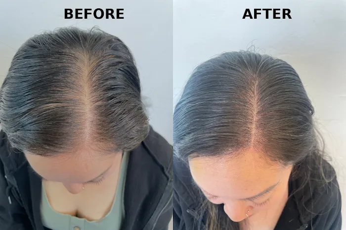 Invisible Ink Skin Solutions Picture 4