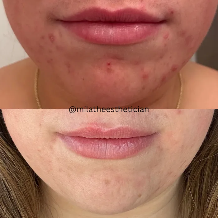 Mila Catapano Aesthetics Picture 3