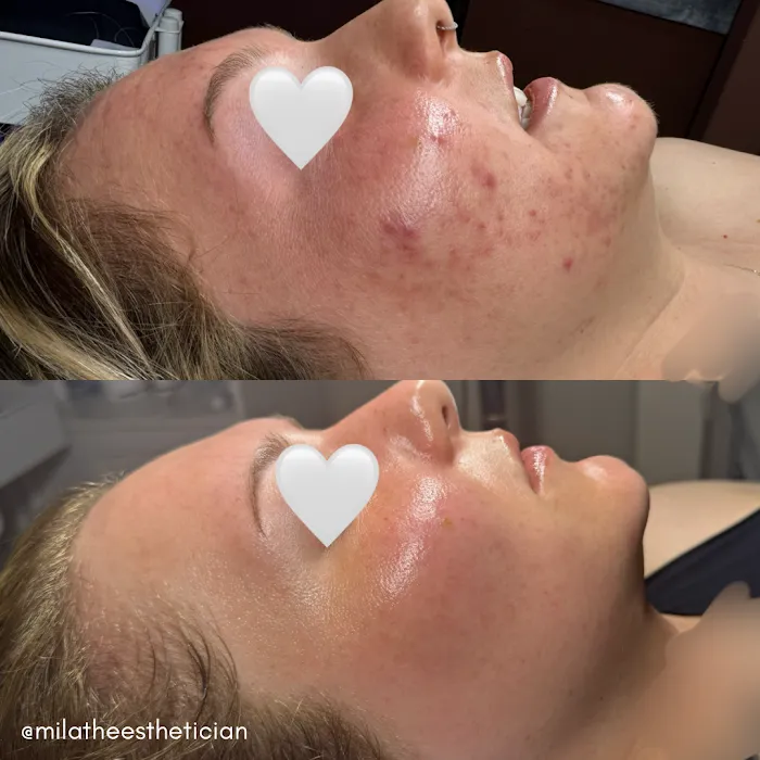 Mila Catapano Aesthetics Picture 5