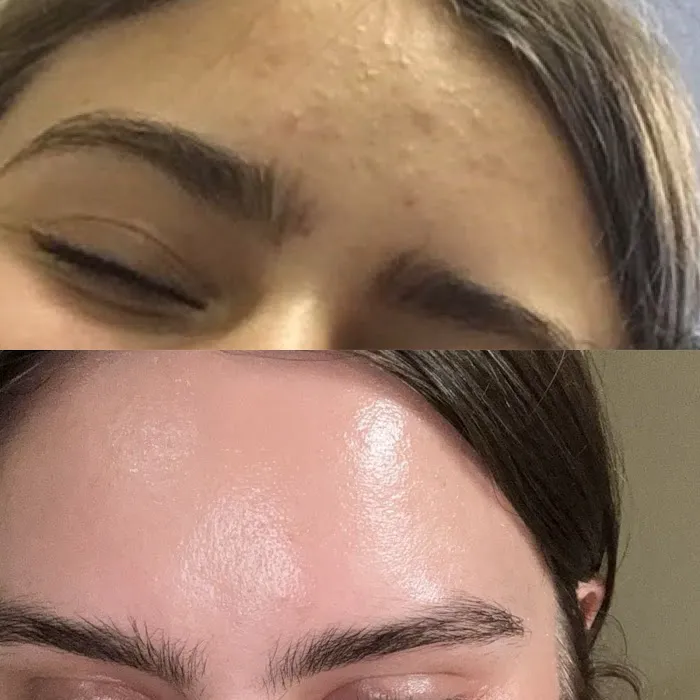 Mila Catapano Aesthetics Picture 4