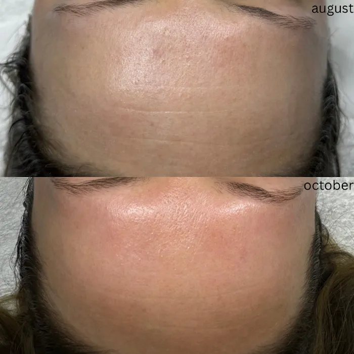 Mila Catapano Aesthetics Picture 6