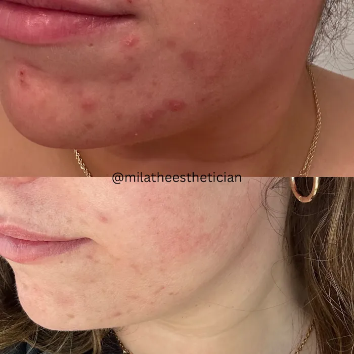 Mila Catapano Aesthetics Picture 7