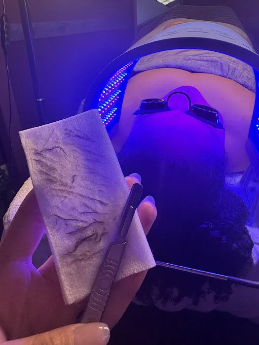 Mila Catapano Aesthetics Picture 8