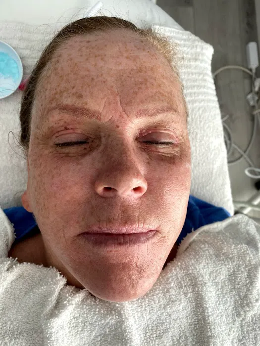 Indulge Vacaville face and body Picture 5