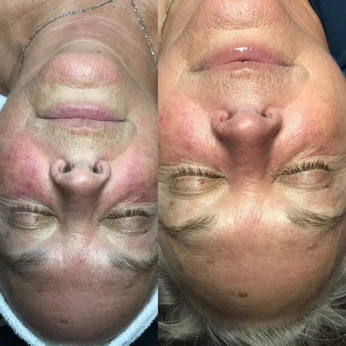 Stacey Carta Skin Care Picture 8