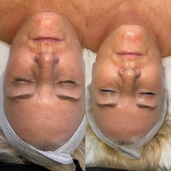 Stacey Carta Skin Care Picture 9