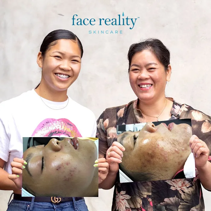 Face Reality Acne Clinic Picture 2