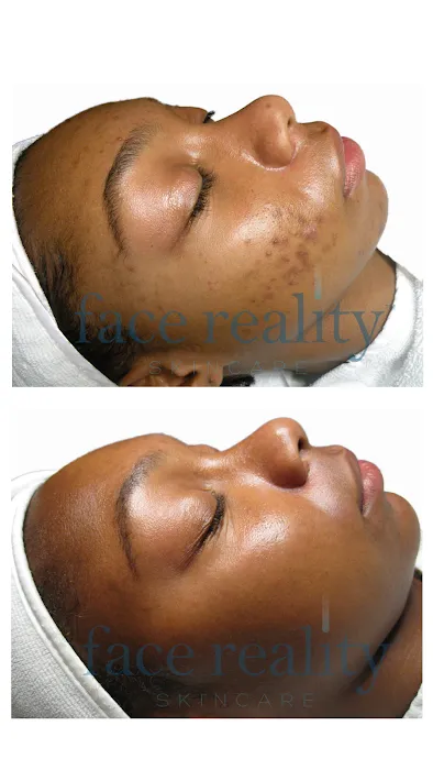 Face Reality Acne Clinic Picture 5