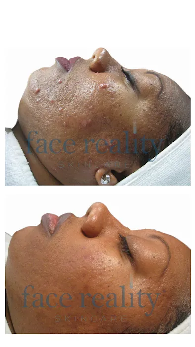 Face Reality Acne Clinic Picture 7