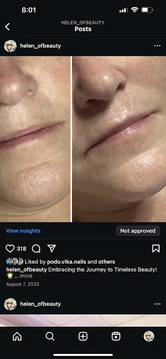 Helen Of Beauty Picture 9