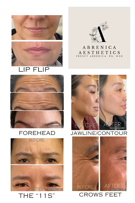 Abrenica Aesthetics Picture 6