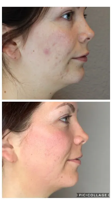 Skin Logic Picture 4