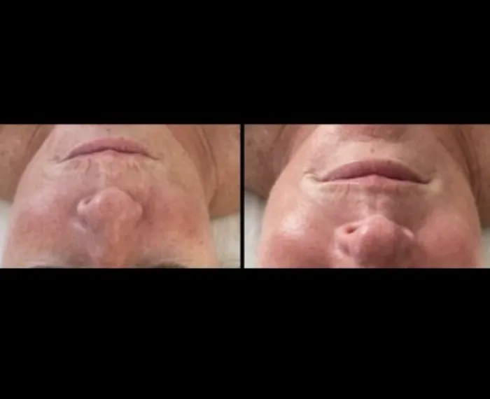 Skin Techniques Picture 7