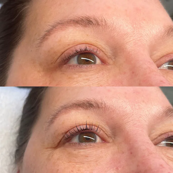 After Glow Aesthetics Picture 1