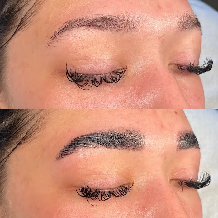 After Glow Aesthetics Picture 3