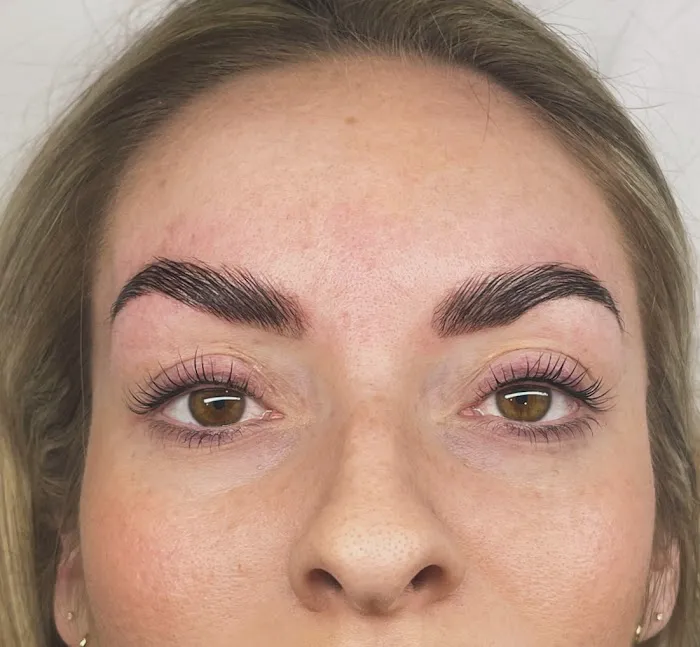 After Glow Aesthetics Picture 2