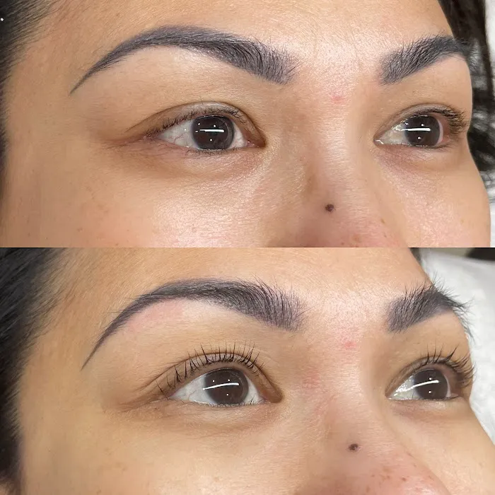 After Glow Aesthetics Picture 7