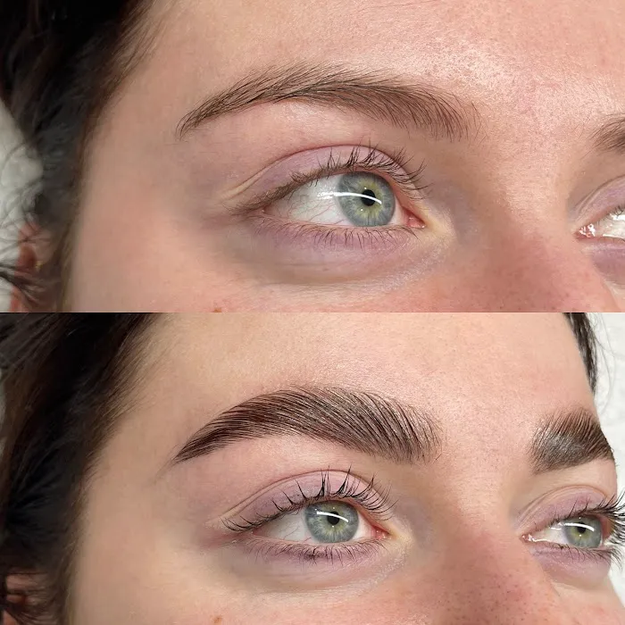 After Glow Aesthetics Picture 6