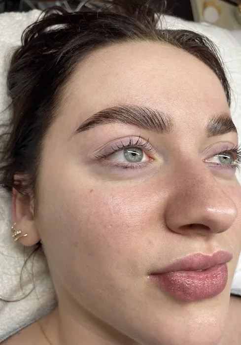 After Glow Aesthetics Picture 5