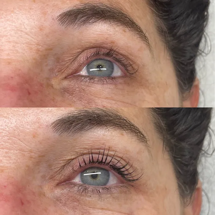 After Glow Aesthetics Picture 4