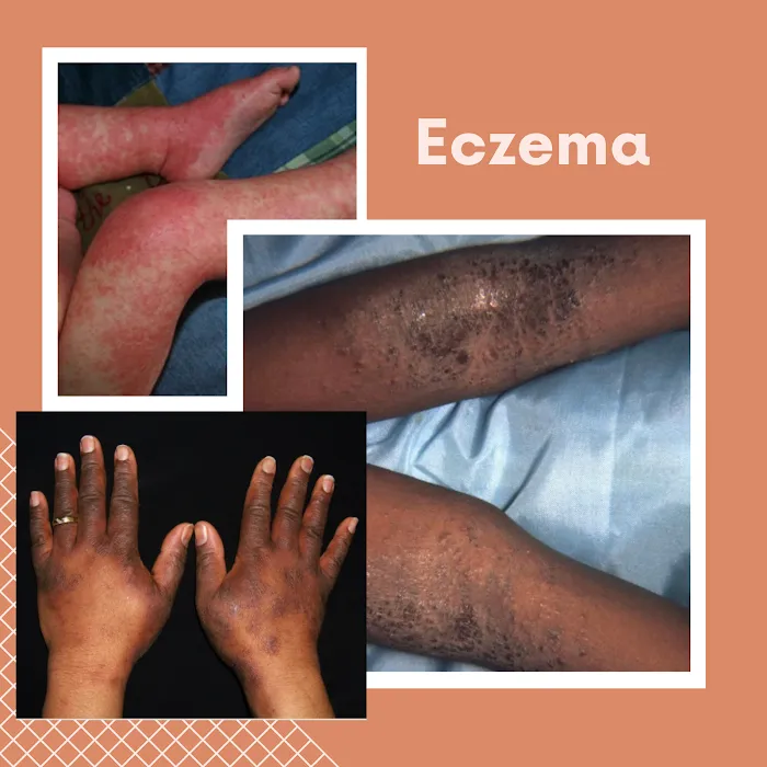 Ronda Simpson Skincare Picture 9