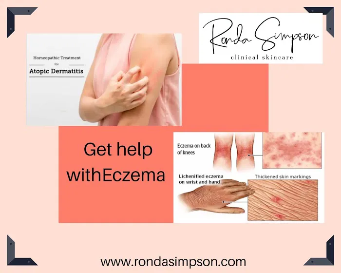 Ronda Simpson Skincare Picture 10