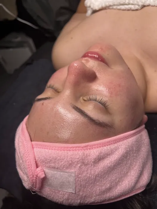 Martini Esthetics Picture 1