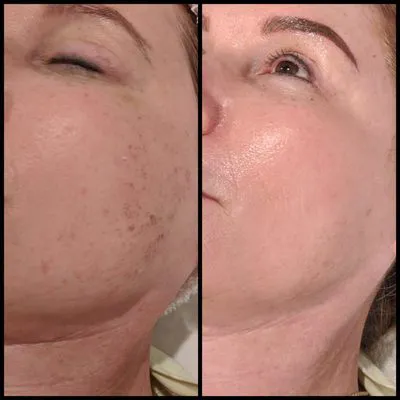 newGLO Skincare Picture 9