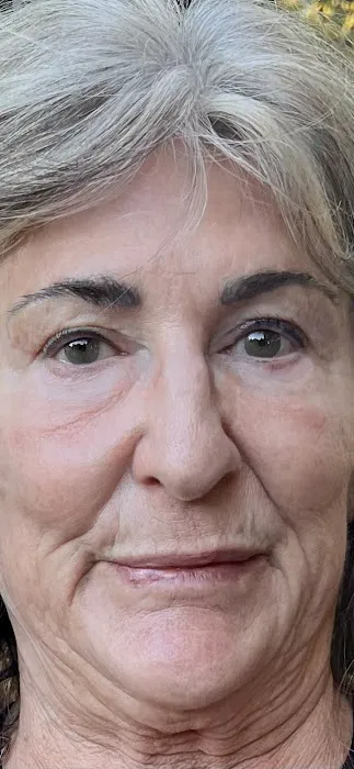 Redwood Empire Dermatology - Healdsburg Picture 1