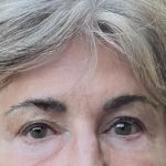 Redwood Empire Dermatology - Healdsburg