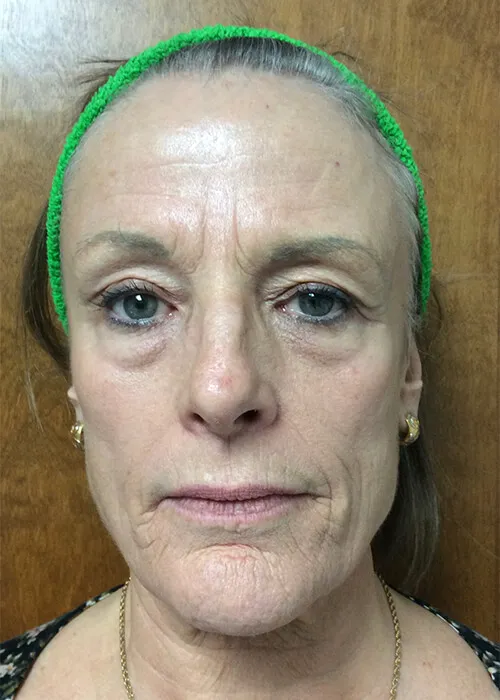 Zormeier Cosmetic Surgery and Longevity Center Picture 1