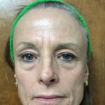 Zormeier Cosmetic Surgery and Longevity Center