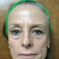 Zormeier Cosmetic Surgery and Longevity Center ico