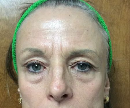 Zormeier Cosmetic Surgery and Longevity Center