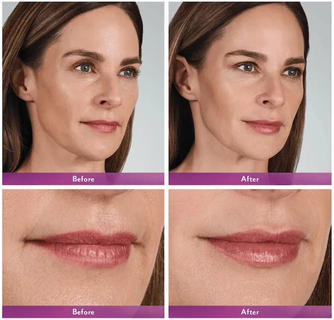 Zormeier Cosmetic Surgery and Longevity Center Picture 9